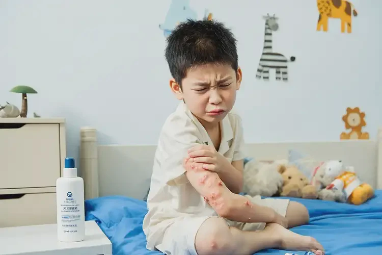 小孩屁股長濕疹不管它會(huì)自己痊愈嗎(圖4)