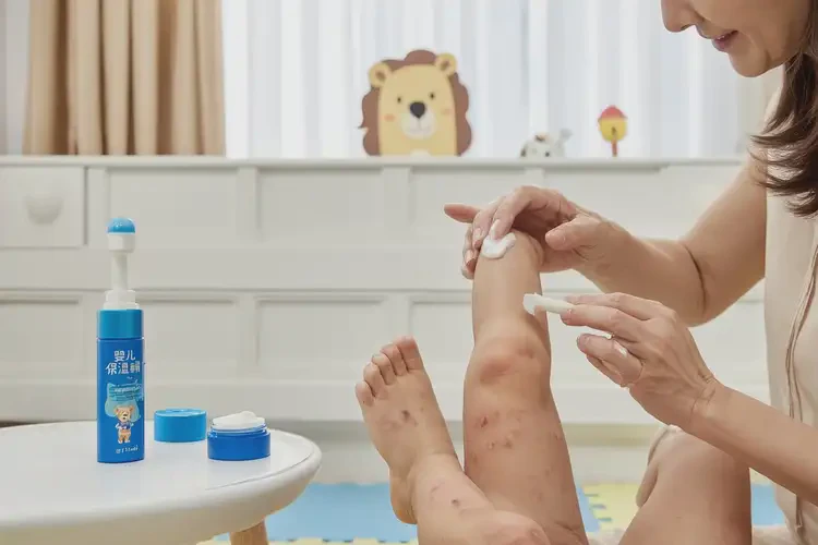 小孩小腿有濕疹能夠徹底治愈嗎(圖2)