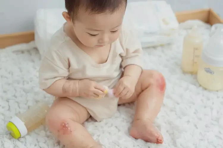 寶寶大腿偶爾起濕疹能徹底自愈嗎(圖4)