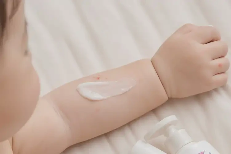 嬰兒手臂上出現(xiàn)濕疹不管它會自己好嗎(圖3)
