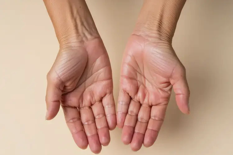 老人四肢長(zhǎng)濕疹能徹底自愈嗎(圖4)