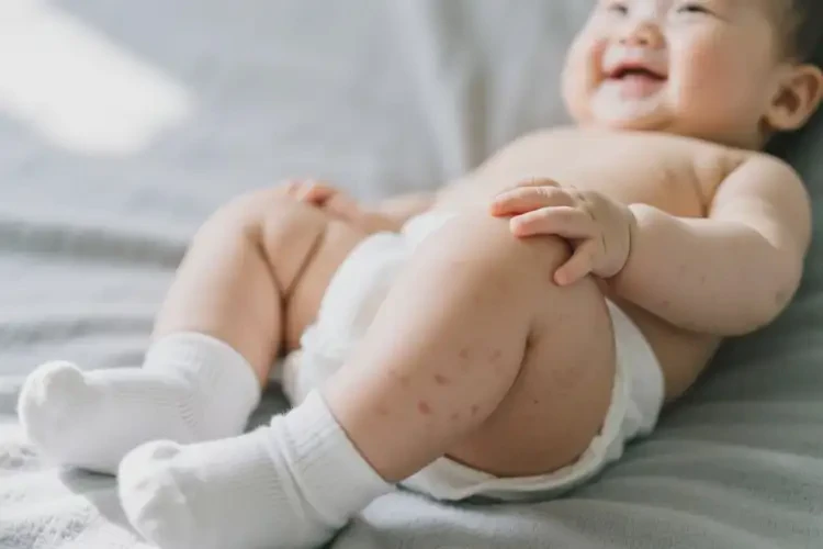 宝宝大腿上偶尔起湿疹不管它会自己痊愈吗(图3)