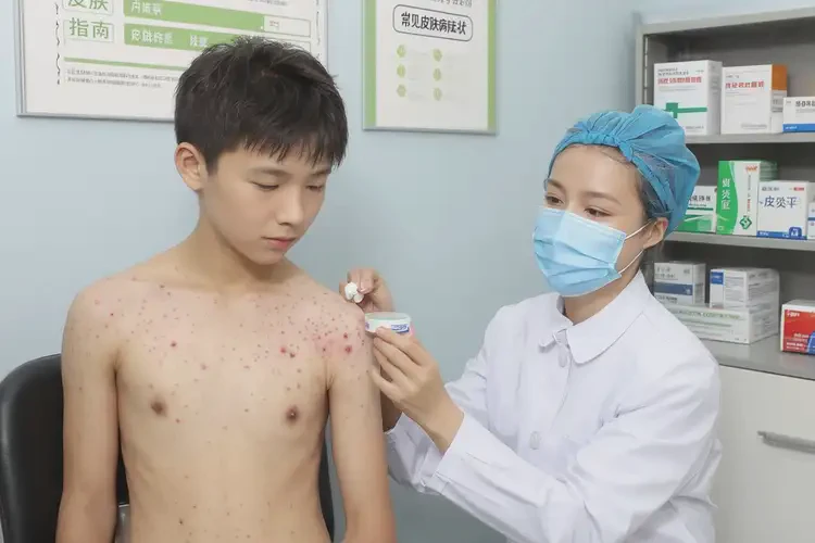 青少年全身長(zhǎng)濕疹不管它會(huì)自己好嗎(圖3)