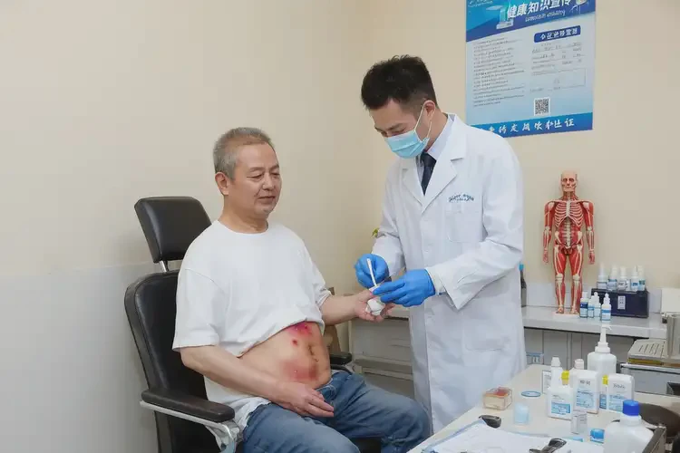 男人肚子起濕疹不管它會自己好嗎(圖3)