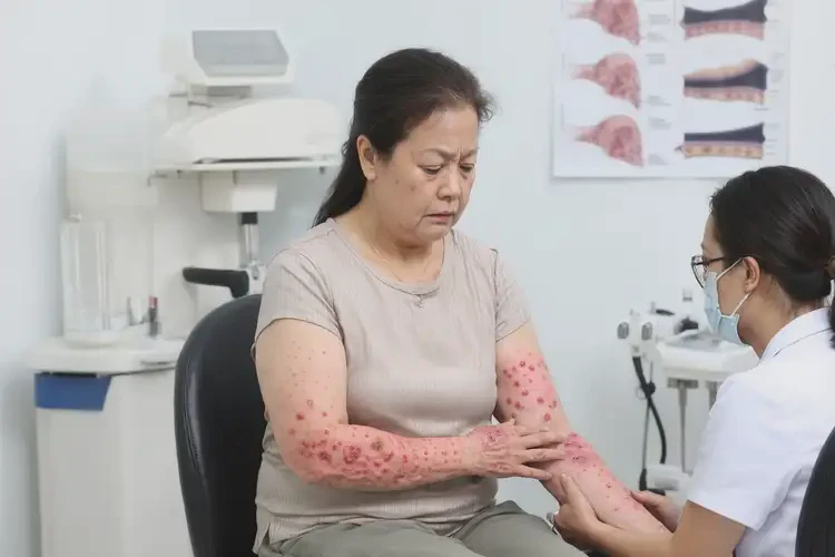 女性四肢有濕疹可以徹底自愈嗎(圖4)