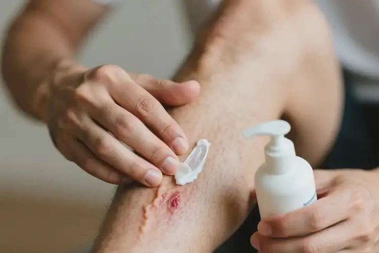 男性小腿上出現(xiàn)濕疹能徹底自愈嗎(圖1)