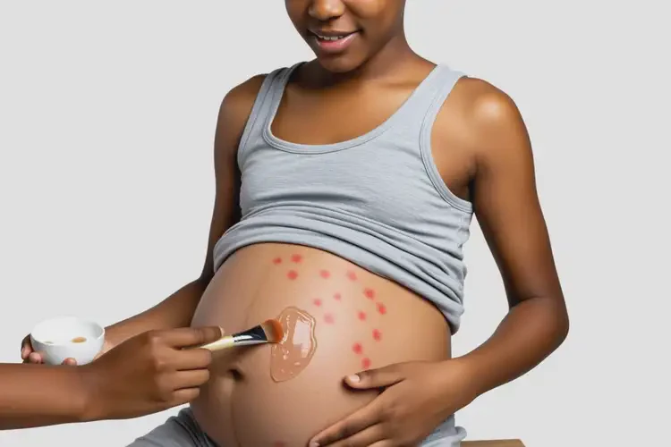 青少年肚子經(jīng)常長濕疹可不可以徹底自愈(圖1)