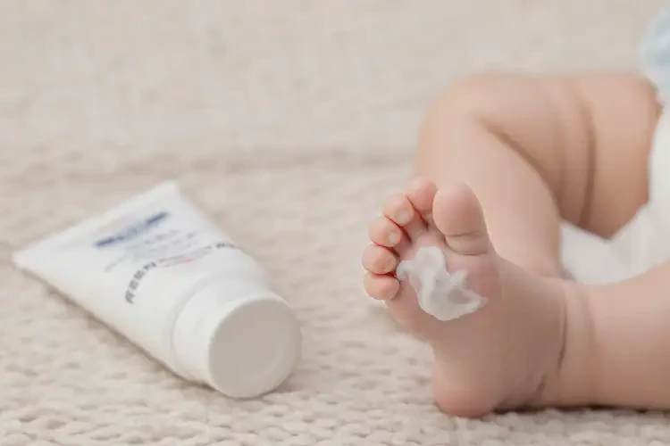 寶寶腳上容易起濕疹能夠徹底治愈嗎(圖3)