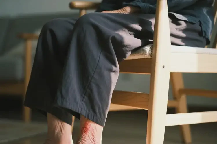 老年人小腿長(zhǎng)濕疹可以徹底自愈嗎(圖4)