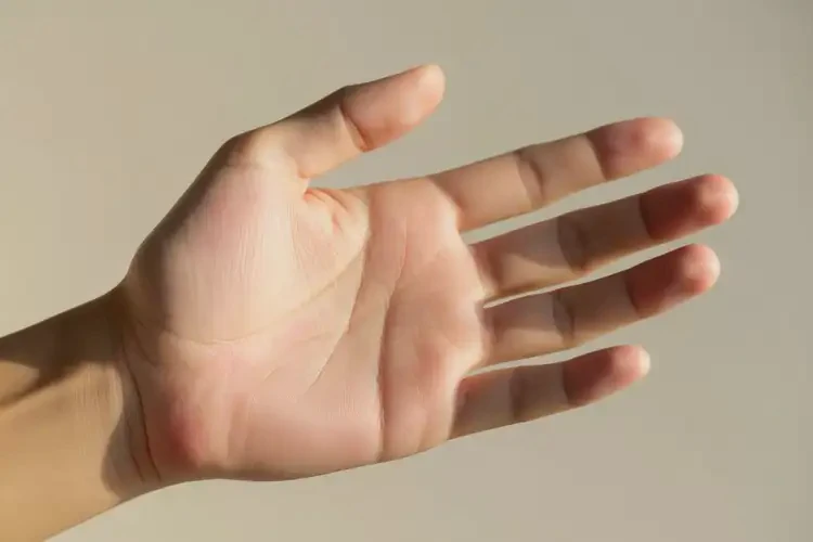 男生手上起濕疹能徹底自愈嗎(圖4)