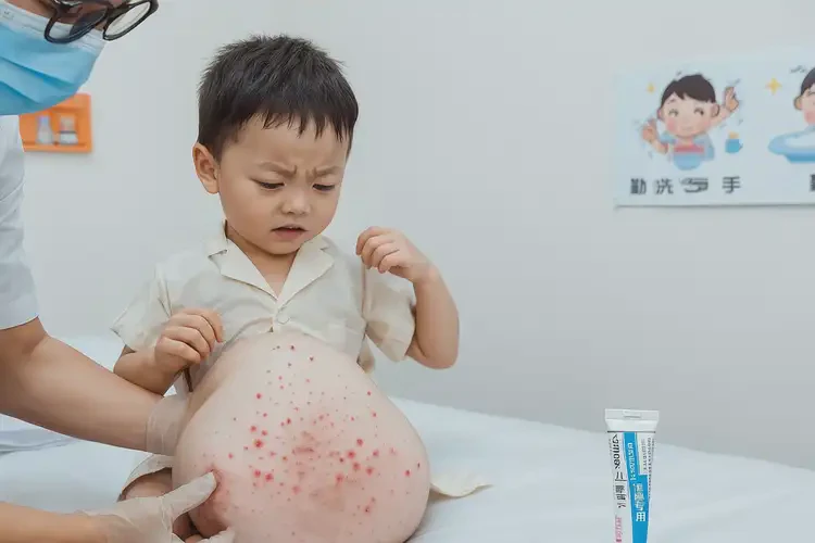 孩子肛周經常起濕疹不管它會自己自愈嗎(圖4)