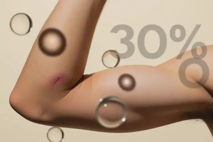 男生手臂上經(jīng)常起濕疹不管它會(huì)自己好嗎(圖3)