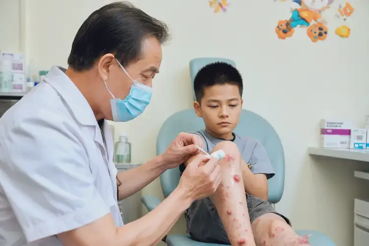 兒童四肢長濕疹能夠徹底治愈嗎(圖3)