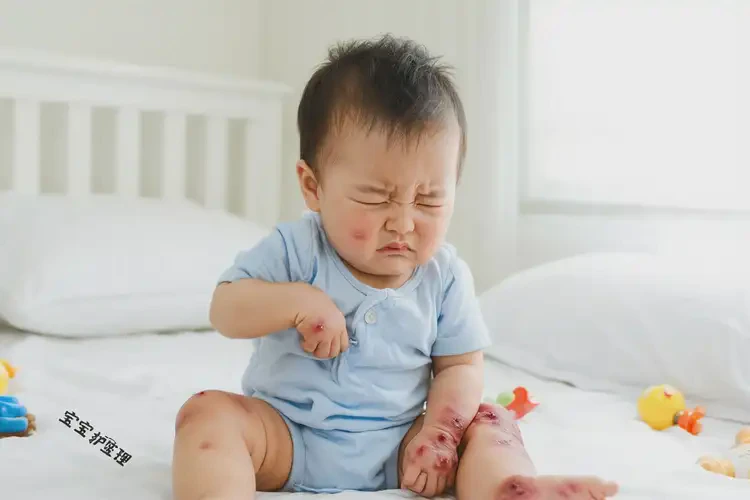 幼儿手臂上有湿疹不管它会自己痊愈吗(图3)