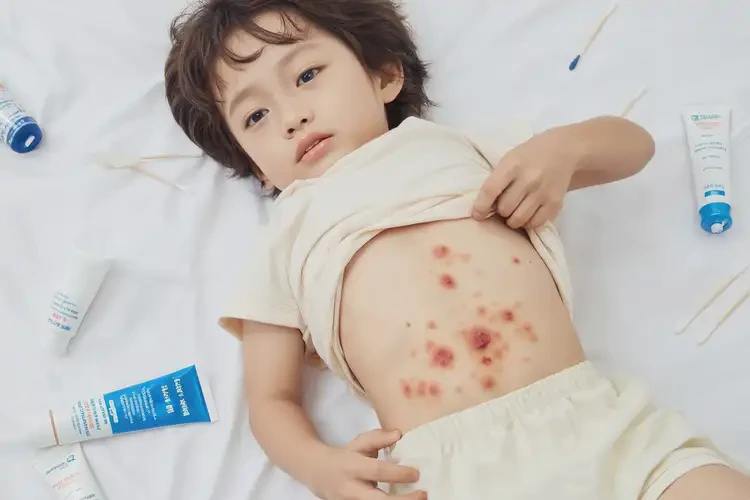 少兒肚子容易長濕疹不管它會自己痊愈嗎(圖4)