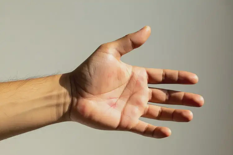 男性手臂上出現(xiàn)濕疹可以徹底自愈嗎(圖1)