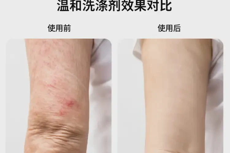 老人手臂有湿疹能靠自己自愈吗(图2)