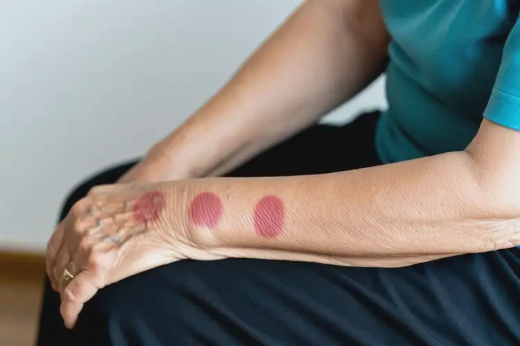 老年人手臂上出现湿疹不管它会自己痊愈吗(图2)