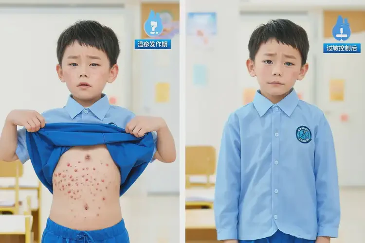 小學(xué)生肚子上出濕疹可以徹底自愈嗎(圖2)