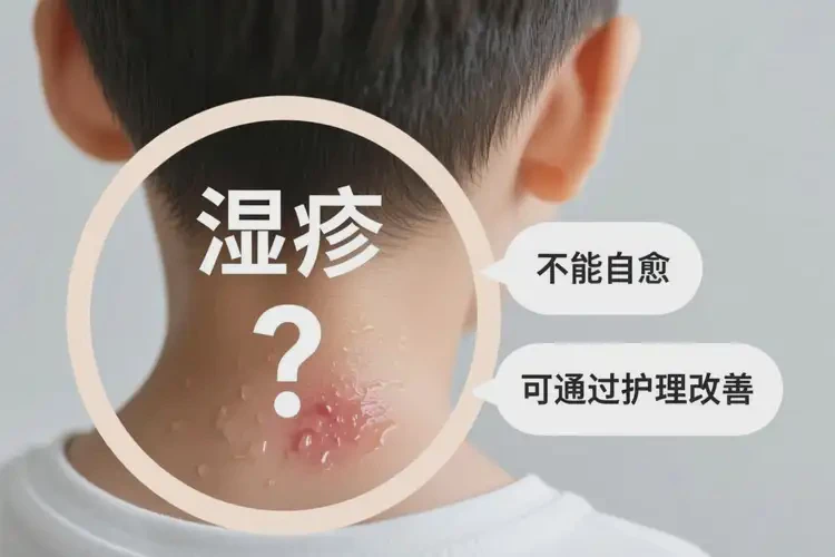 孩子脖子上有濕疹能徹底自愈嗎(圖2)
