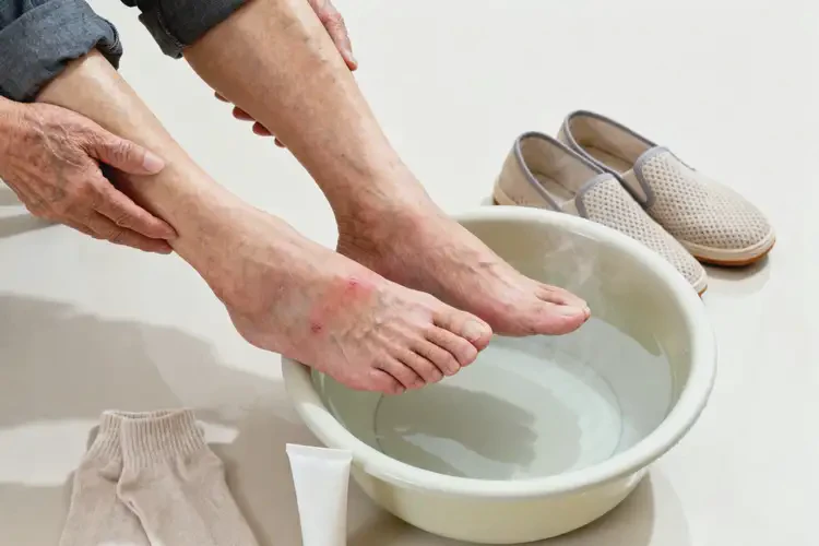 老年人腳上偶爾起濕疹能靠自己自愈嗎(圖2)