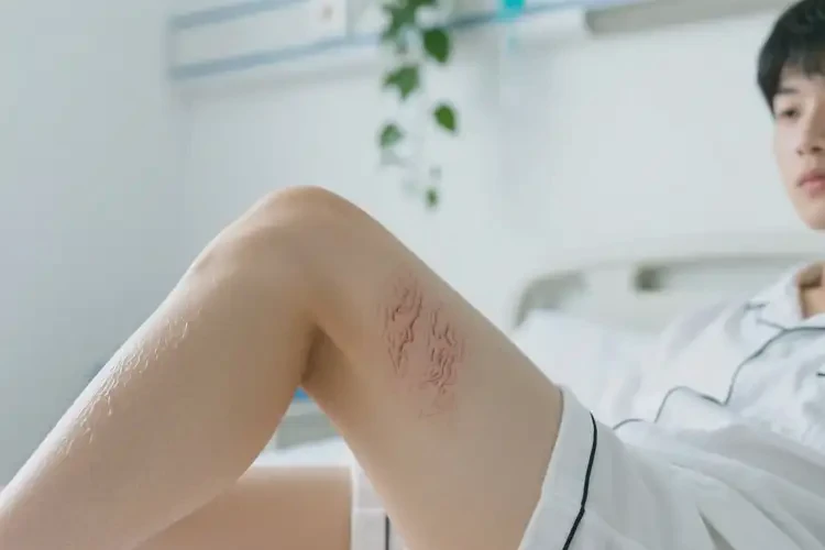 大學(xué)生大腿上經(jīng)常起濕疹能徹底自愈嗎(圖3)