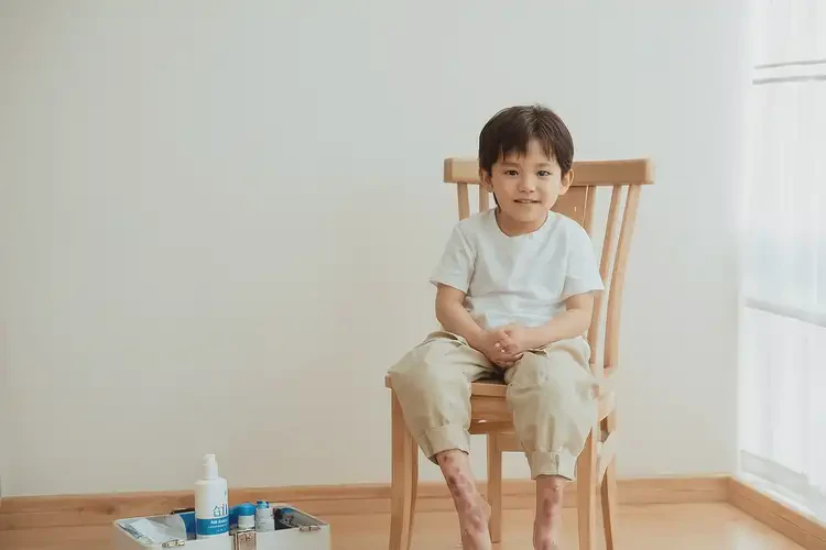 小孩腳上偶爾長濕疹能夠徹底治愈嗎(圖2)