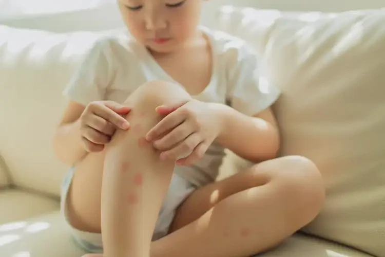 小孩大腿上偶尔长湿疹能够彻底治愈吗(图3)