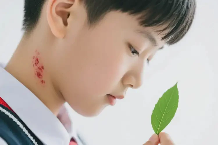 中學(xué)生脖子有濕疹能不能徹底自愈(圖3)