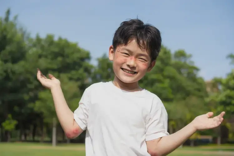 青少年全身容易起濕疹能徹底自愈嗎(圖4)