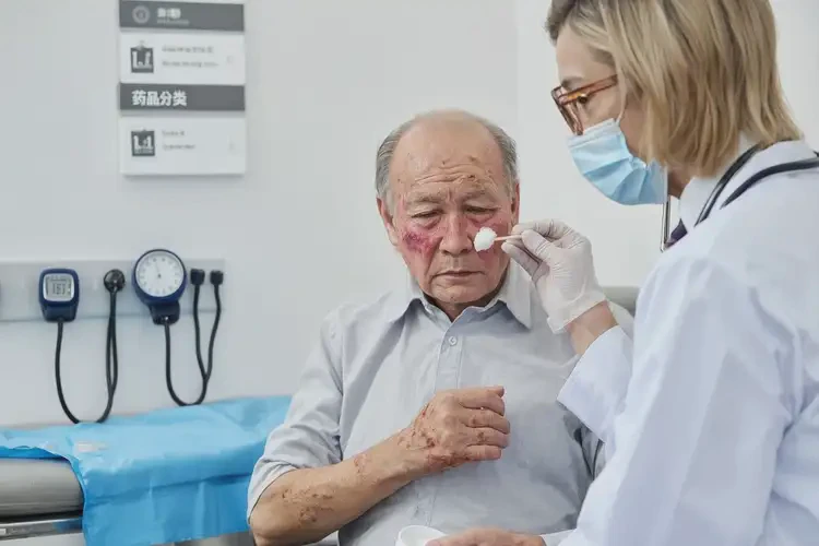 老年人臉上容易長(zhǎng)濕疹不管它會(huì)自己好嗎(圖3)