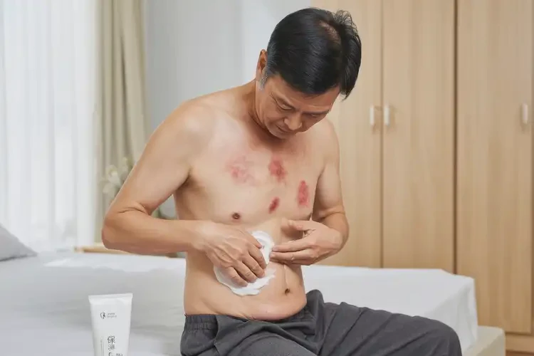 男性肚子上出湿疹能靠自己自愈吗(图2)