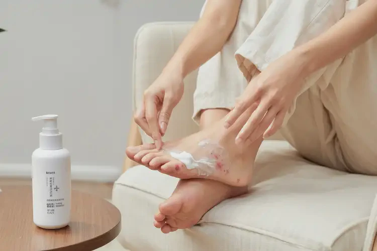 孕婦腳上經(jīng)常起濕疹能徹底自愈嗎(圖3)