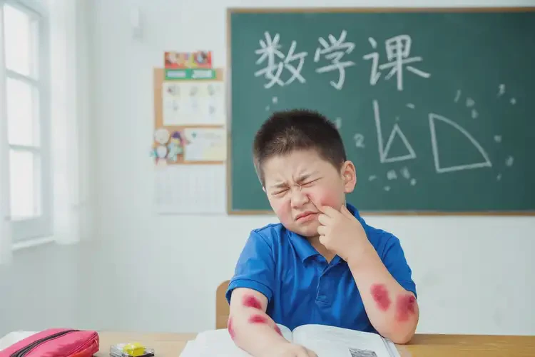 小学生屁股上容易长湿疹能靠自己自愈吗(图3)