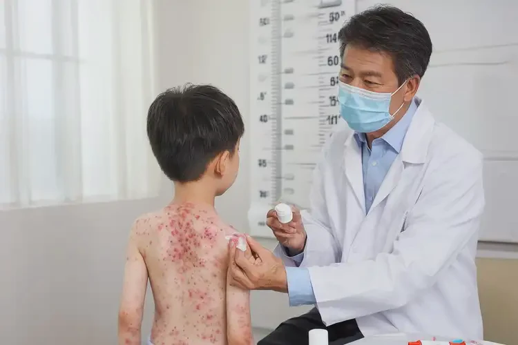 孩子全身出現(xiàn)濕疹可以徹底自愈嗎(圖3)