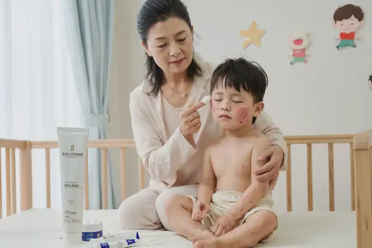 少兒臉上經(jīng)常長濕疹不管它會自己好嗎(圖3)