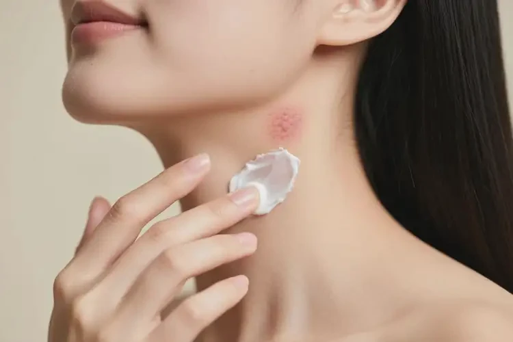 女人脖子出現(xiàn)濕疹能不能徹底自愈(圖3)