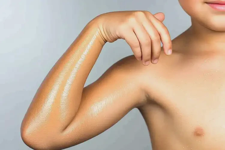 小孩手臂起湿疹能彻底自愈吗(图1)