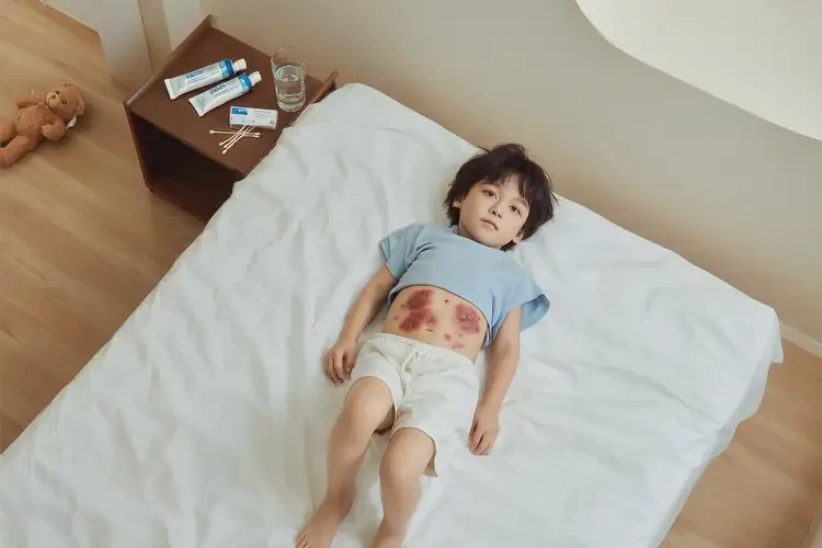 少兒肚子容易長濕疹不管它會自己痊愈嗎(圖2)