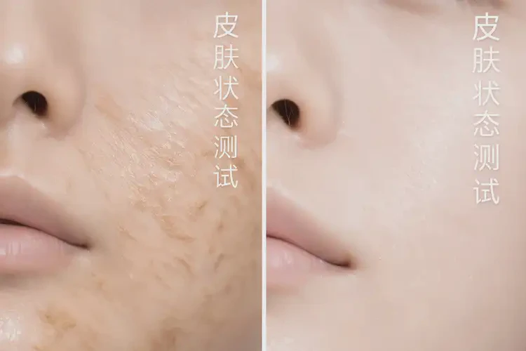 少兒大腿上偶爾長(zhǎng)濕疹不管它會(huì)自己痊愈嗎(圖3)