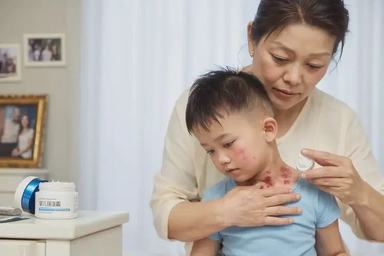 小孩脖子上容易長(zhǎng)濕疹可以徹底自愈嗎(圖3)