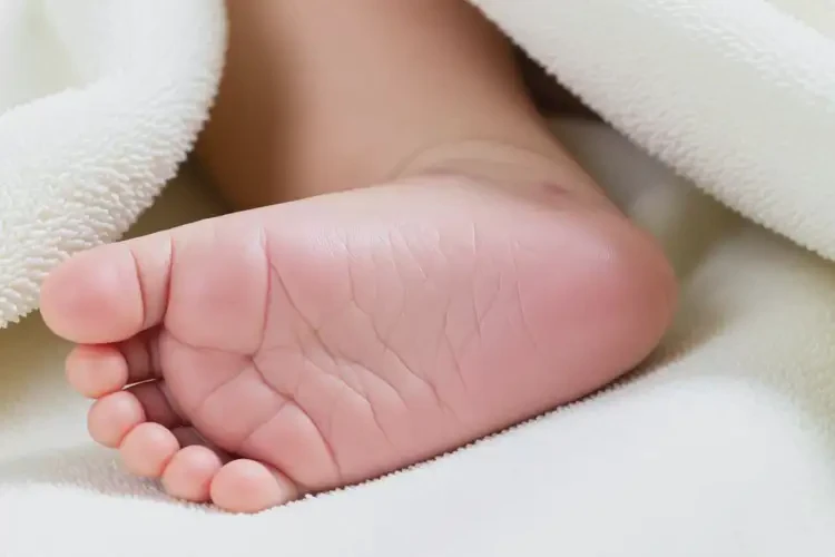 嬰兒腳上長濕疹可以徹底自愈嗎(圖4)