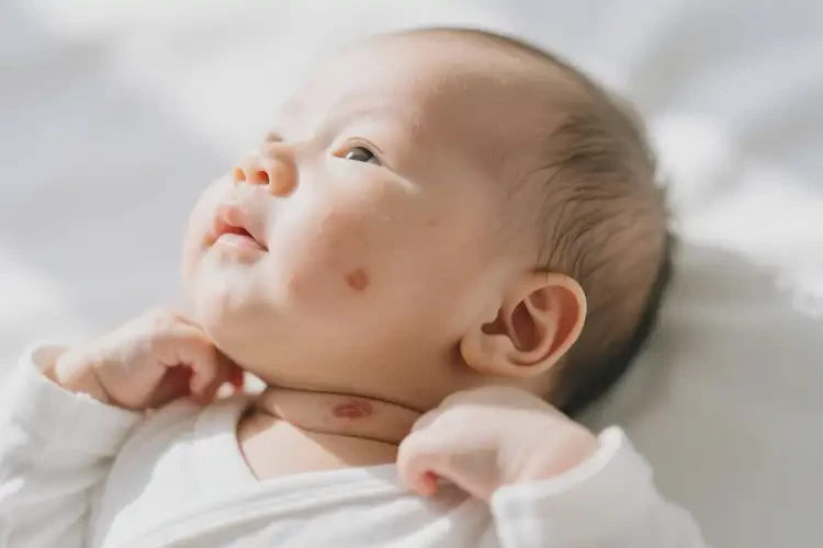 嬰幼兒脖子經(jīng)常起濕疹能靠自己自愈嗎(圖4)