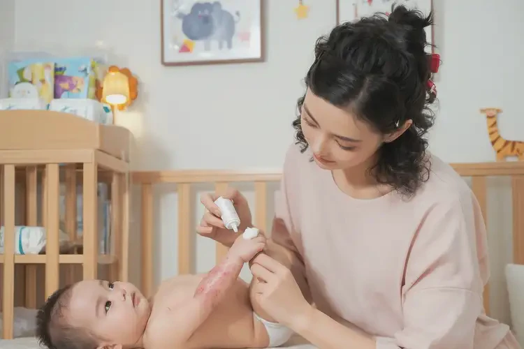嬰幼兒手臂有濕疹能靠自己自愈嗎(圖3)