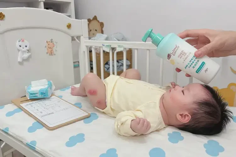 嬰幼兒脖子經(jīng)常長濕疹不管它會(huì)自己自愈嗎(圖2)