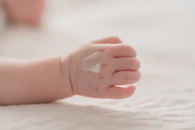 新生兒手上起濕疹不管它會(huì)自己痊愈嗎(圖3)