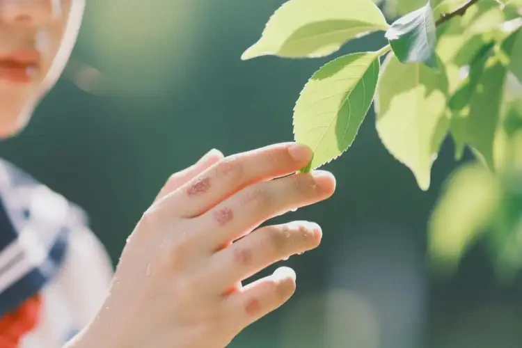 中學(xué)生身上經(jīng)常起濕疹可以徹底自愈嗎(圖2)