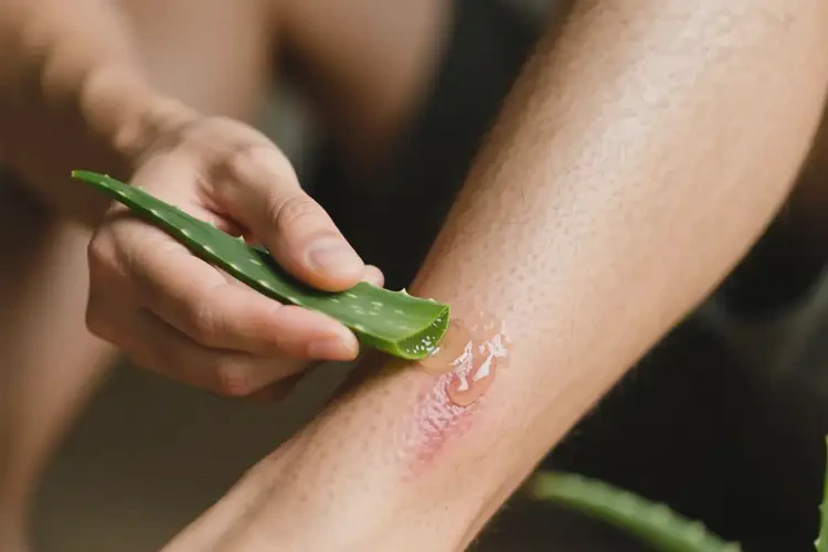 男性小腿經(jīng)常起濕疹不管它會自己自愈嗎(圖3)