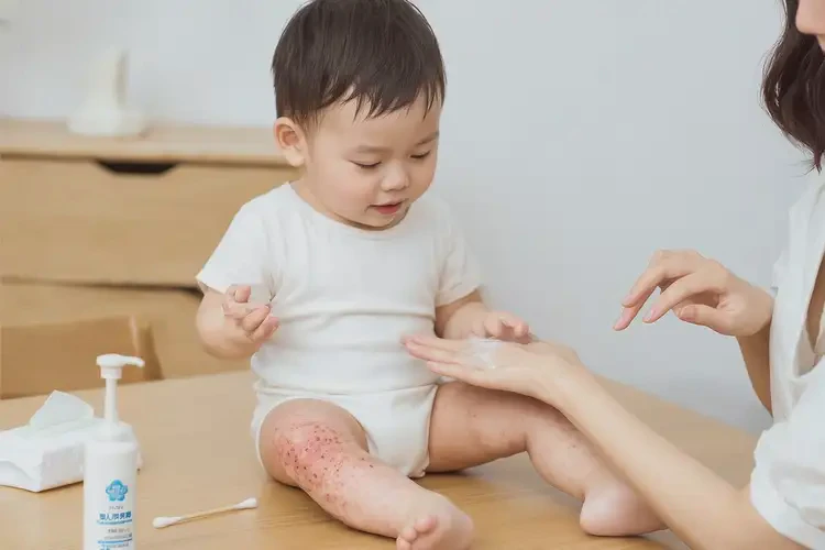 幼兒小腿有濕疹能徹底自愈嗎(圖3)