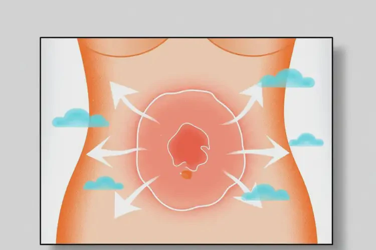 女性肚子容易起濕疹可以徹底自愈嗎(圖1)